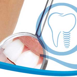 Estética dental