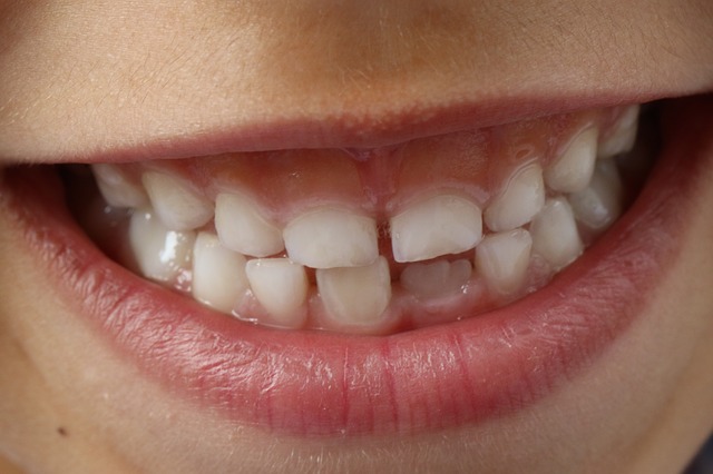 Las caries dentales en los niños cómo prevenirlas y tratarlas adecuadamente