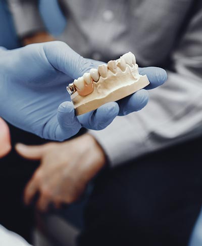 prótesis dental