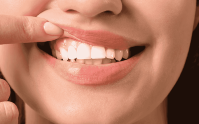 ¿Por qué sangran mis encías al cepillarme los dientes?